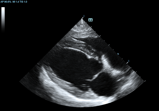 Long Axis View of Canine Heart